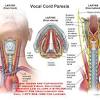 The neck is an extremely complicated place in the body. 1