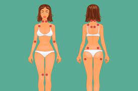 Veja o mapa dos pontos de dor da fibromialgia e entenda o diagnóstico. 18 Principais Pontos De Dor Da Fibromialgia Tua Saude