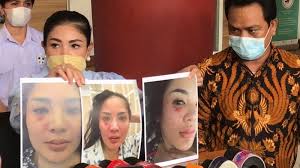 Suami ditangkap narkoba, 9 fakta pernikahan nindy ayunda & askara. Nindy Ayunda Ungkap Bukti Kdrt Sejak Awal Nikah Okezone Celebrity