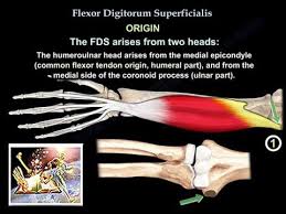 The muscle belly divides into 4 tendons. Flexor Digitorum Superficialis Everything You Need To Know Dr Nabil Ebraheim Youtube