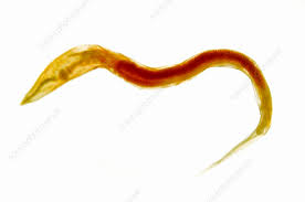 Image result for Pinworm