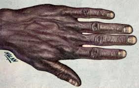 Image result for Mees Line