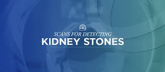 Scans For Detecting Kidney Stones Health Images