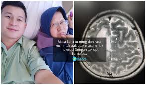 Sensasi sakitnya juga sering digambarkan seperti adanya. Mungkin Terlalu Stress Bersedih Kematian Isteri Derita Kerap Sakit Kepala Rupa Rupanya