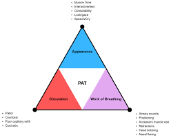 Image result for Pediatric Assessment Triangle