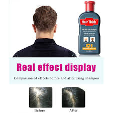 Cutelove Anti Hair Loss Shampoo Natural Ingredient Based Effective Solution Hair Growth Serum Hair Loss Anti Hair Loss Shampoo Hair Loss Shampoo Anti Hair Loss