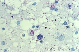 Image result for Rickettsiae