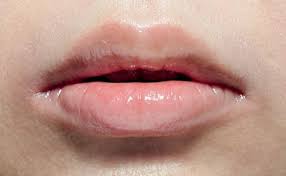 Uneven Upper Lip One Side Of The Philtrum Is Larger Than The Other How To Line Lips Perfect Lips Lips