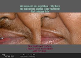 Book your laser hair removal consultation at forever young medical spa in philadelphia, pa today. Ambiguitate Nefolosit Abandonat Laser Hair Removal Philadelphia Lmvdesigns Com