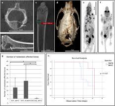 Breast cancer that has spread to the bones is known as secondary or metastatic breast cancer in the bone. Plos One Species Dependent Extracranial Manifestations Of A Brain Seeking Breast Cancer Cell Line