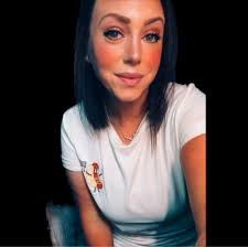 LOVE HURTS Despite my foot and entire leg being swollen and with pins  holding it together. I don't have the heart to tell Lucky, that him trying  to comfort me....actually hurts :)