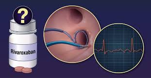 Image result for Anticoagulation