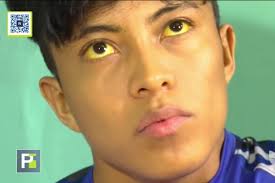 Fundraiser by Giannina Fredo : Help Numan Pay For His Liver Transplant