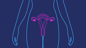 Sign up & get support today. Depo Provera Birth Control Shot Birth Control Injection
