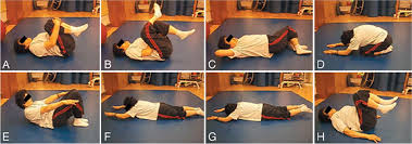 Cervical thoracic lumbar sacral orthosis. How Does Back Muscle Strength Change After Posterior Lumbar Interbody Fusion In Journal Of Neurosurgery Spine Volume 26 Issue 2 2017