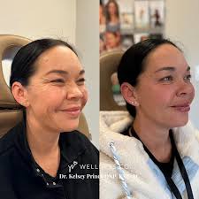 Medspa & Concierge Medicine Clinic Zeeland MI