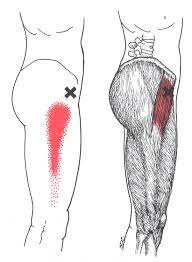 Tensor Fasciae Latae The Trigger Point Referred Pain Guide