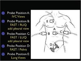 Limited transthoracic echocardiogram performed by me: The Rush Exam Step 2 Evaluation Of The Tank Download Scientific Diagram
