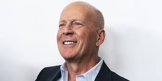 Bruce Greenwood's Wife Susan Devlin Was His High School Sweetheart