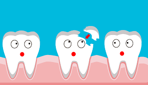 What To Do If You Chip Your Tooth Dental Brothers