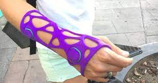 Spanish Company To Trial 3d Printed Casts In 2020 3d Printing Technology 3d Printing 3d Printing Business