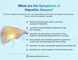 Image result for hepatitis symptoms
