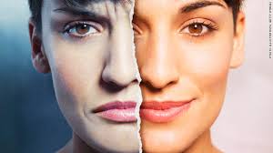 Tiêu chuẩn chẩn đoán Rối loạn lưỡng cực I theo DSM-5 (Bipolar I Disorder)