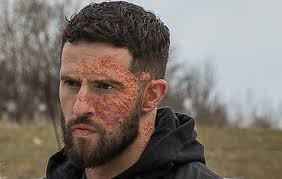 Emmerdale's deeply troubled Ross Barton turns to cocaine