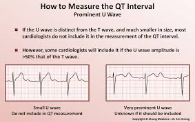 Image result for U Wave