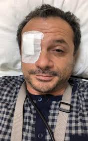 Cateno De Luca: "Ancora non sono pronto. Fase riabilitativa più lenta e  complicata del previsto"