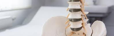 Erosive Osteochondrose Gemeinschaftspraxis Fur Neurochirurgie
