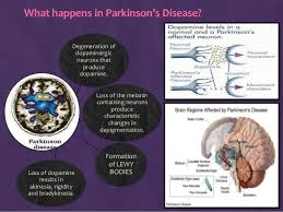 However, not all of them are well understood. Parkinson S Disease