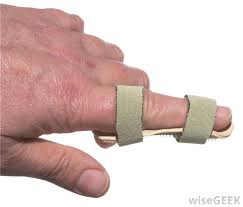 Jul 29, 2019 · the recovery time for a broken finger maybe as short as a few weeks or up to a year, depending upon multiple factors. What Is The Treatment For A Finger Fracture With Pictures
