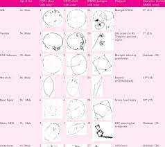 Begin here (1) and draw a line from 1 then to a then to 2 and so on. Clock Drawing And Mmse Pentagons In Various Neurological Disorders Download Table