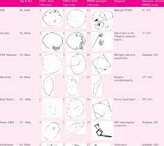 Jun 25, 2021 · moca scoring nuances with clock draw : Clock Drawing And Mmse Pentagons In Various Neurological Disorders Download Table