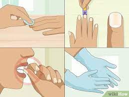 May 05, 2021 · if you are finding yourself constantly irritated around your cuticles, there are several steps to take. 9 Easy Ways To Stop Itchy Cuticles Wikihow