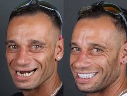 Casal Maloka': veja antes e depois de ex-moradores de rua que têm 2M de  seguidores