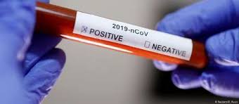 Resultado de imagem para covid 19 sintomas