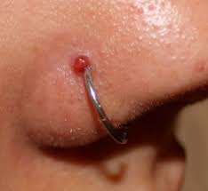 A Comprehensive Guide To Piercing Bumps