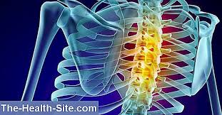 Cea mai frecventa cauza de durere in segmentul anterior al toracelui, care in trecut era diagnosticata gresit ca. Durere In ArticulaÈ›ia Coloanei Vertebrale Toracice Hernia De Disc Cum Apare Simptome Tratament