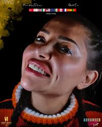 8 adet çok katmanlı monolitik zirkonyum restorasyon Vaka kapsamında;  estetik, fonksiyon ve doğal renk geçişleri esas alınarak ileri seviye smile  design planlamasına uygun laboratuvar üretimi gerçekleştirilmiştir. 🦷 •  Çok katmanlı yapı ile