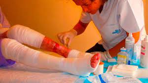 Mas De Mil Personas Padecen En Espana La Piel De Mariposa