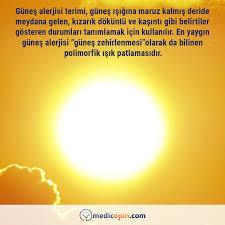 Gunes Alerjisi Nedir Movie Posters Movies Poster