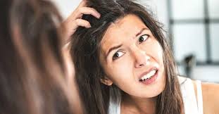 An itchy scalp does not really indicate anything too serious but it could also be a symptom of an these are white dry flakes of dead skin on your hair and scalp from excessive skin production. Dandruff What Your Itchy Scalp Is Trying To Tell You
