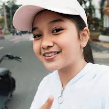 Catur mengaku saat ini kondisinya sedang sakit, bahkan, dihadapan penyidik saat dilakukan pemeriksaan catur sengaja menunjukkan gelang tanda pasien rumah sakit. Naisa Alifia Yuriza Youtuber Cilik Kini Dekat Fateh Halilintar