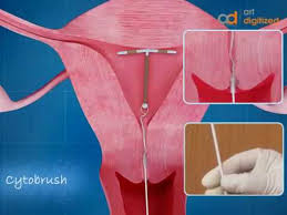 We did not find results for: Ø´Ø±Ø­ ØªØ±ÙƒÙŠØ¨ Ø§Ù„Ù„ÙˆÙ„Ø¨ Iud ÙˆØ§Ø²Ø§Ù„ØªÙ‡ Ø·Ø±ÙŠÙ‚Ø© Ù…Ù†Ø¹ Ø§Ù„Ø­Ù…Ù„ Youtube