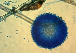 Aspergillus Mold Facts And Removal Tips Clean Water Partners