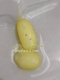 القيء بعد تناول الإفطار بعد الصيام السلام عليكم ورحمة الله وبركاته مشكلتي تتلخص في الصيام فطالما كنت صائما لا توجد مشكلة ولكن عند الإفطار وبمجرد تناول أي طعام أو شراب تهيج المعدة وينتابني القيء ولقد استشرت أطباء. ØµÙˆØ± Ù„Ø¨Ø¹Ø¶ Ø­Ø§Ù„Ø§Øª Ø§Ù„Ø³Ø­Ø± Ø§Ù„Ø°ÙŠ ØªÙ… Ø§Ø³ØªØ®Ø±Ø§Ø¬Ù‡ Ø´Ø¨ÙƒØ© Ø§Ù„Ø´ÙØ§Ø¡ Ø§Ù„Ø¹Ø§Ù„Ù…ÙŠØ©