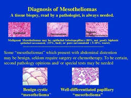 Epithelioid mesothelioma is the most common type of asbestos cancer. Understanding Malignant Epithelial Mesothelioma Mesothelioma Cancer