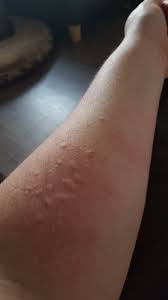 Dawn Pring On Twitter Allergic Reaction To My Dog Great Just Great Https T Co Eju52guduz